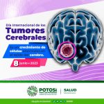 BANNER TUMORES CEREBRALES 8JUN2023