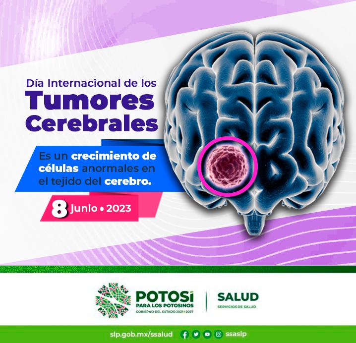 BANNER TUMORES CEREBRALES 8JUN2023